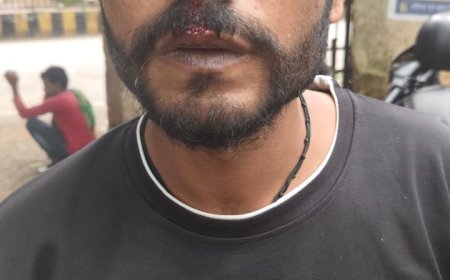 ऑटो चालक को पीटकर पलटा दिया ऑटो, खुद को बता रहे थे पुलिसकर्मी 